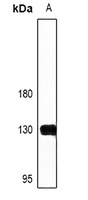 NFAT1 Rabbit Polyclonal Antibody