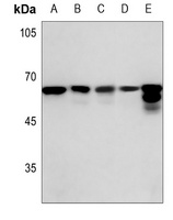 FYN Rabbit Polyclonal Antibody
