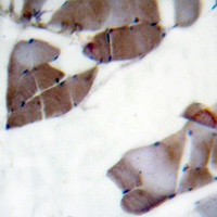 ACC alpha Rabbit Polyclonal Antibody