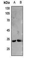 DARPP32 Rabbit Polyclonal Antibody