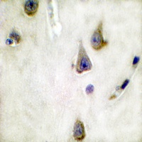 DARPP32 Rabbit Polyclonal Antibody