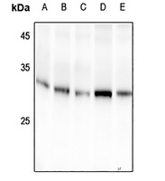 14-3-3 sigma (Phospho-S186) Antibody