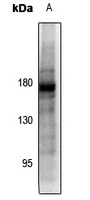 PDGFR beta (Phospho-Y857) Antibody
