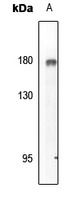 EGFR (Phospho-Y869) Antibody