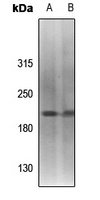 Topoisomerase 2 alpha (Phospho-S1213) Antibody