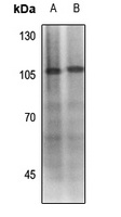 MDM2 (Phospho-S186/S188) Antibody