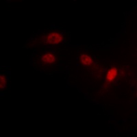 MDM2 (Phospho-S186/S188) Antibody