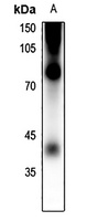 Rhodopsin (Phospho-S334) Antibody