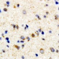 Rhodopsin (Phospho-S334) Antibody