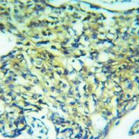 Anti-USP51 Antibody