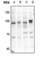 HGS Rabbit Polyclonal Antibody