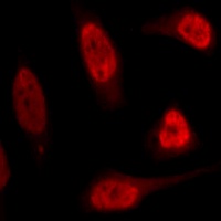 p53 Rabbit Polyclonal Antibody