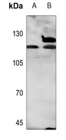 Androgen Receptor Rabbit Polyclonal Antibody