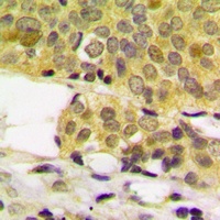 Androgen Receptor Rabbit Polyclonal Antibody