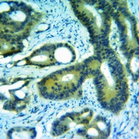 Anti-SerpinB1 Antibody