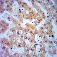 Mimecan antibody