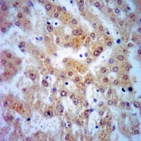 Anti-Mimecan Antibody