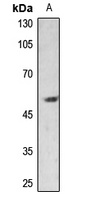 PAR1 Rabbit Polyclonal Antibody