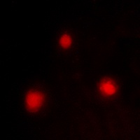 Anti-FOXH1 Antibody