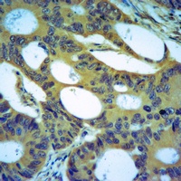Anti-Von Willebrand Factor Antibody