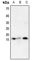 Histone H4 (MonoMethyl-K16) Rabbit Polyclonal Antibody