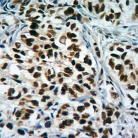Anti-Histone H3 (TriMethyl-K4) Antibody