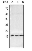 Histone H2B (Butyryl-K23) Rabbit Polyclonal Antibody