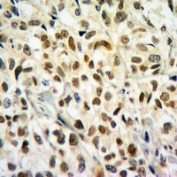 Histone H2B (Butyryl-K20) Rabbit Polyclonal Antibody
