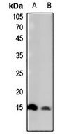 Histone H2B (Butyryl-K15) Rabbit Polyclonal Antibody