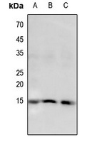 Histone H2B (Butyryl-K5) Antibody
