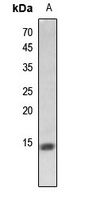 Histone H2A (Butyryl-K5) Rabbit Polyclonal Antibody