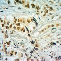 Histone H2A (Butyryl-K5) Rabbit Polyclonal Antibody