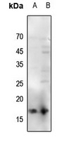 Histone H3 (Acetyl-K56) Antibody