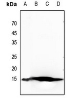 Histone H2B (Acetyl-K20) Antibody