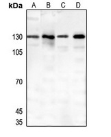 Thrombospondin 4 Rabbit Polyclonal Antibody