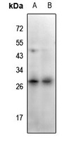 CD159c Rabbit Polyclonal Antibody