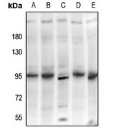 PI3K p85 beta Rabbit Polyclonal Antibody