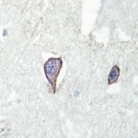 PDGFR alpha Antibody