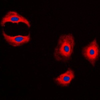Anti-MMP3 Antibody
