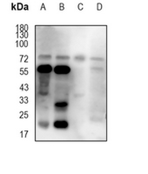 CD122 Rat Monoclonal Antibody