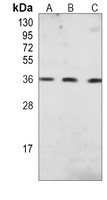 UCH-L5 Mouse Monoclonal Antibody