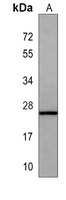 Neurogenin 3 Mouse Monoclonal Antibody