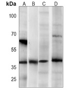 AMPK beta 1 Antibody