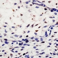 Anti-SUFU Antibody