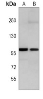 p100 Mouse Monoclonal Antibody