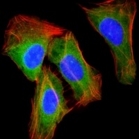 Anti-RAB23 Antibody