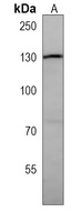 EPHA6 Mouse Monoclonal Antibody