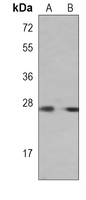 DKK2 Mouse Monoclonal Antibody