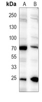 NLK Mouse Monoclonal Antibody