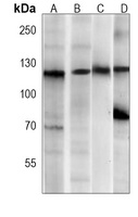 PERK Mouse Monoclonal Antibody